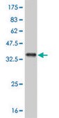 Monoclonal Anti-ABL2 antibody produced in mouse clone 5C6, purified immunoglobulin, buffered aqueous solution