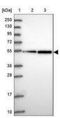 Anti-TUBB8 antibody produced in rabbit Prestige Antibodies® Powered by Atlas Antibodies, affinity isolated antibody, buffered aqueous glycerol solution