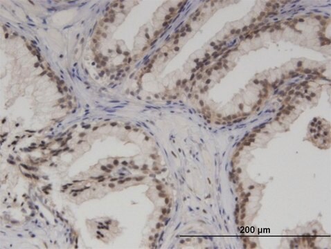 Monoclonal Anti-SMARCA5 antibody produced in mouse clone 3F4, purified immunoglobulin, buffered aqueous solution