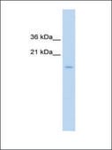 Anti-CENPA antibody produced in rabbit IgG fraction of antiserum