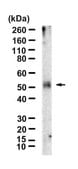 Anti-CCR4/CD194 Antibody, clone 1N13 ZooMAb&#174; Rabbit Monoclonal recombinant, expressed in HEK 293 cells