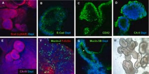 3dGRO® Human iPSC Derived Colon Organoids Normal, Dermal Fibroblast, Age: Neonatal, Male, Mutation: None