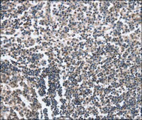Anti-CAMTA1 antibody produced in rabbit affinity isolated antibody