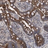 Anti-TTC19 antibody produced in rabbit Prestige Antibodies&#174; Powered by Atlas Antibodies, affinity isolated antibody, buffered aqueous glycerol solution