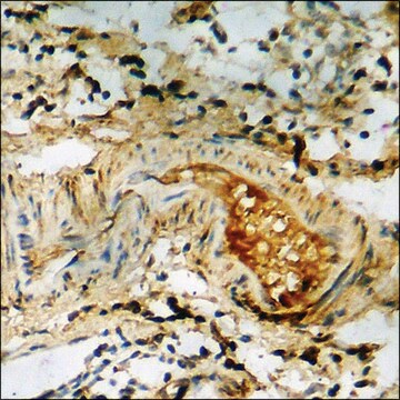 Anti-phospho-DAPK2 (pSer318) antibody produced in rabbit affinity isolated antibody