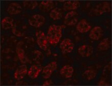 Anti-ENC-1 antibody produced in chicken affinity isolated antibody, buffered aqueous solution