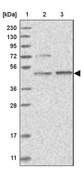 Anti-AARSD1 antibody produced in rabbit Prestige Antibodies&#174; Powered by Atlas Antibodies, affinity isolated antibody, buffered aqueous glycerol solution, Ab3