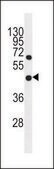 ANTI-GDPD1 (N-TERM) antibody produced in rabbit IgG fraction of antiserum, buffered aqueous solution