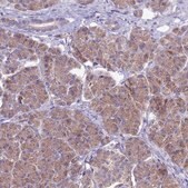 Anti-ETFDH antibody produced in rabbit Prestige Antibodies&#174; Powered by Atlas Antibodies, affinity isolated antibody, buffered aqueous glycerol solution