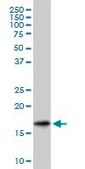 Monoclonal Anti-SNCG antibody produced in mouse clone 2C3, purified immunoglobulin, buffered aqueous solution