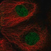 Anti-MAD2L1 antibody produced in rabbit Prestige Antibodies&#174; Powered by Atlas Antibodies, affinity isolated antibody, buffered aqueous glycerol solution
