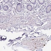 Anti-TLR4 antibody produced in rabbit Prestige Antibodies&#174; Powered by Atlas Antibodies, affinity isolated antibody, buffered aqueous glycerol solution