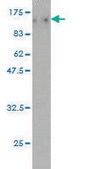 Monoclonal Anti-TOP3B antibody produced in mouse clone 4F11, purified immunoglobulin, buffered aqueous solution