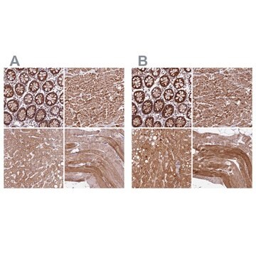 Anti-NDUFA8 antibody produced in rabbit Prestige Antibodies&#174; Powered by Atlas Antibodies, affinity isolated antibody, buffered aqueous glycerol solution