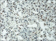 Anti-acetyl-Histone H3 (Ac-Lys9) antibody produced in rabbit 2-2.5&#160;mg/mL, affinity isolated antibody, buffered aqueous solution