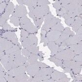 Anti-NEUROD6 Prestige Antibodies® Powered by Atlas Antibodies, affinity isolated antibody