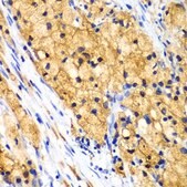 Anti-CAPG antibody produced in rabbit