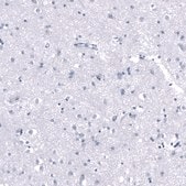 Monoclonal Anti-PNMT antibody produced in mouse Prestige Antibodies® Powered by Atlas Antibodies, clone CL11434, purified antibody (Protein A)