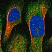 Anti-AHRR antibody produced in rabbit Prestige Antibodies&#174; Powered by Atlas Antibodies, affinity isolated antibody, buffered aqueous glycerol solution, Ab1