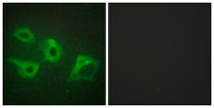 Anti-CKI-α antibody produced in rabbit affinity isolated antibody