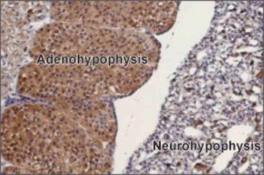 Anti-TRPC3 antibody produced in rabbit affinity isolated antibody, lyophilized powder