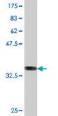 Monoclonal Anti-ATG5, (C-terminal) antibody produced in mouse clone 1C4, purified immunoglobulin, buffered aqueous solution