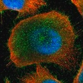 Anti-ZBTB33 antibody produced in rabbit Ab2, Prestige Antibodies&#174; Powered by Atlas Antibodies, affinity isolated antibody, buffered aqueous glycerol solution