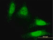 Monoclonal Anti-DAZ1 antibody produced in mouse clone 3G10, purified immunoglobulin, buffered aqueous solution