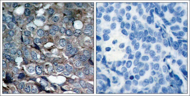 Anti-phospho-MAP3K5 (pSer83) antibody produced in rabbit affinity isolated antibody