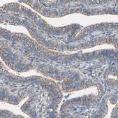 Anti-TPBG antibody produced in rabbit Prestige Antibodies® Powered by Atlas Antibodies, affinity isolated antibody, buffered aqueous glycerol solution