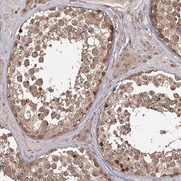 Anti-TBC1D23 antibody produced in rabbit Prestige Antibodies&#174; Powered by Atlas Antibodies, affinity isolated antibody, buffered aqueous glycerol solution