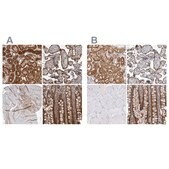 Anti-NAPRT antibody produced in rabbit Prestige Antibodies&#174; Powered by Atlas Antibodies, affinity isolated antibody, buffered aqueous glycerol solution, Ab1