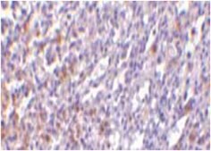 Anti-IL27RA Antibody from rabbit, purified by affinity chromatography