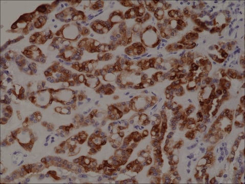 Anti-TPO (Thyroid Peroxidase) antibody, Rabbit monoclonal recombinant, expressed in HEK 293 cells, clone RM368, purified immunoglobulin