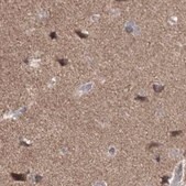 Anti-PDS5A antibody produced in rabbit Prestige Antibodies&#174; Powered by Atlas Antibodies, affinity isolated antibody, buffered aqueous glycerol solution