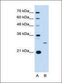 Anti-ASPH IgG fraction of antiserum