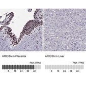 Anti-ARID3A antibody produced in rabbit Prestige Antibodies® Powered by Atlas Antibodies, affinity isolated antibody, buffered aqueous glycerol solution