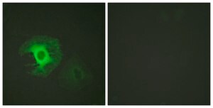 Anti-Caldesmon antibody produced in rabbit affinity isolated antibody