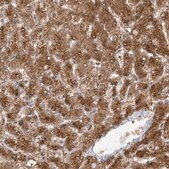 Anti-TTC38 antibody produced in rabbit Prestige Antibodies® Powered by Atlas Antibodies, affinity isolated antibody, buffered aqueous glycerol solution