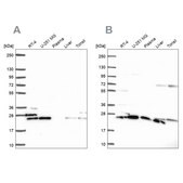 Anti-RPS5 antibody produced in rabbit Prestige Antibodies&#174; Powered by Atlas Antibodies, affinity isolated antibody, buffered aqueous glycerol solution