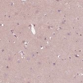 Anti-CCDC114 antibody produced in rabbit Prestige Antibodies&#174; Powered by Atlas Antibodies, affinity isolated antibody, buffered aqueous glycerol solution