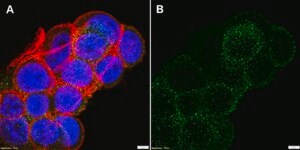 Anti-NOX2/gp91phox Antibody, clone 1J16 ZooMAb&#174; Rabbit Monoclonal recombinant, expressed in HEK 293 cells