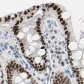 抗-ZBTB7B 兔抗 Prestige Antibodies&#174; Powered by Atlas Antibodies, affinity isolated antibody, buffered aqueous glycerol solution, Ab1