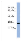 Anti-RAB1A antibody produced in rabbit affinity isolated antibody