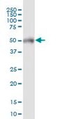 Anti-POTEA antibody produced in mouse purified immunoglobulin