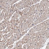 Anti-AGAP2 antibody produced in rabbit Prestige Antibodies&#174; Powered by Atlas Antibodies, affinity isolated antibody, buffered aqueous glycerol solution