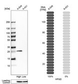 Anti-HPGD antibody produced in rabbit Prestige Antibodies&#174; Powered by Atlas Antibodies, affinity isolated antibody, buffered aqueous glycerol solution