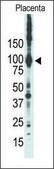 Anti-PKCε (N-term) antibody produced in rabbit IgG fraction of antiserum, buffered aqueous solution
