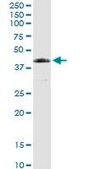 Anti-FANCL antibody produced in rabbit purified immunoglobulin, buffered aqueous solution
