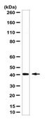 Anti-ST6GAL1 Antibody from rabbit, purified by affinity chromatography